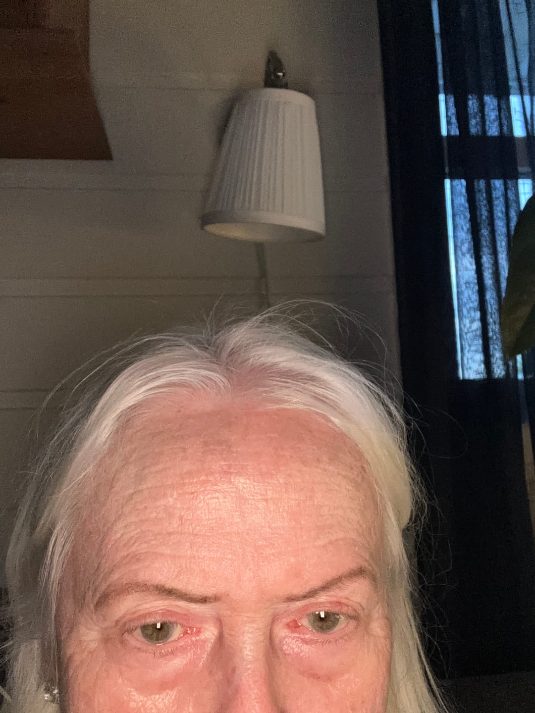 Reseña fotográfica de un cliente sobre el bálsamo para ojos