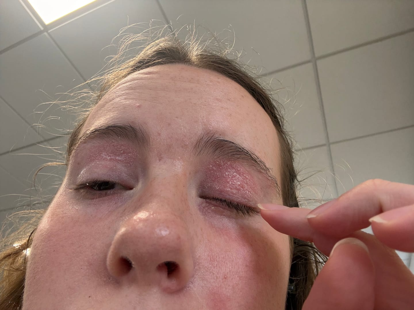 Customer photo review of Calm Balm