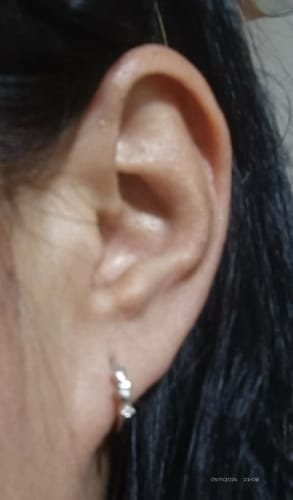 Customer photo review of Gesundheitsohrringe - Magnettherapie Ohrringe