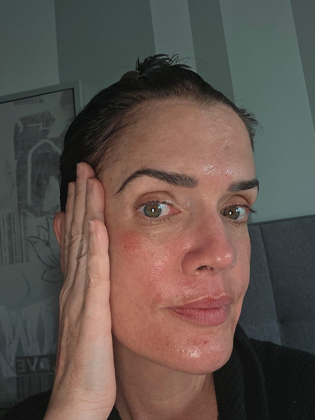 Customer photo review of Micro Infusion Patches