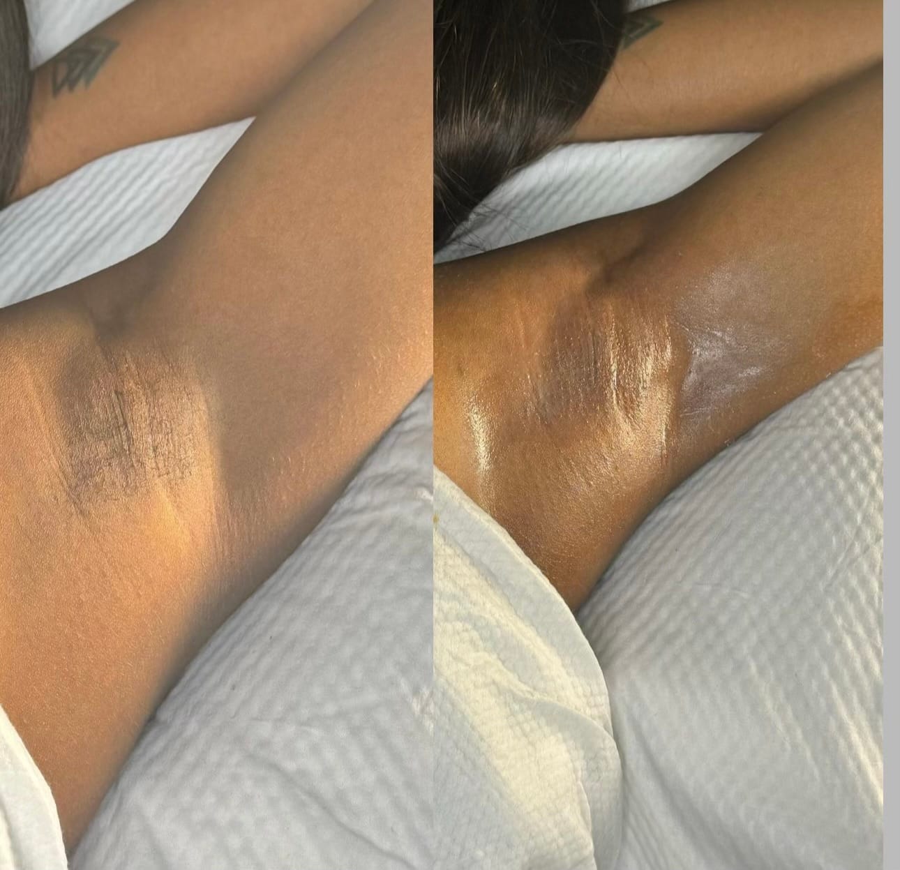 Customer photo review of Signature Series Hair Removal Wax