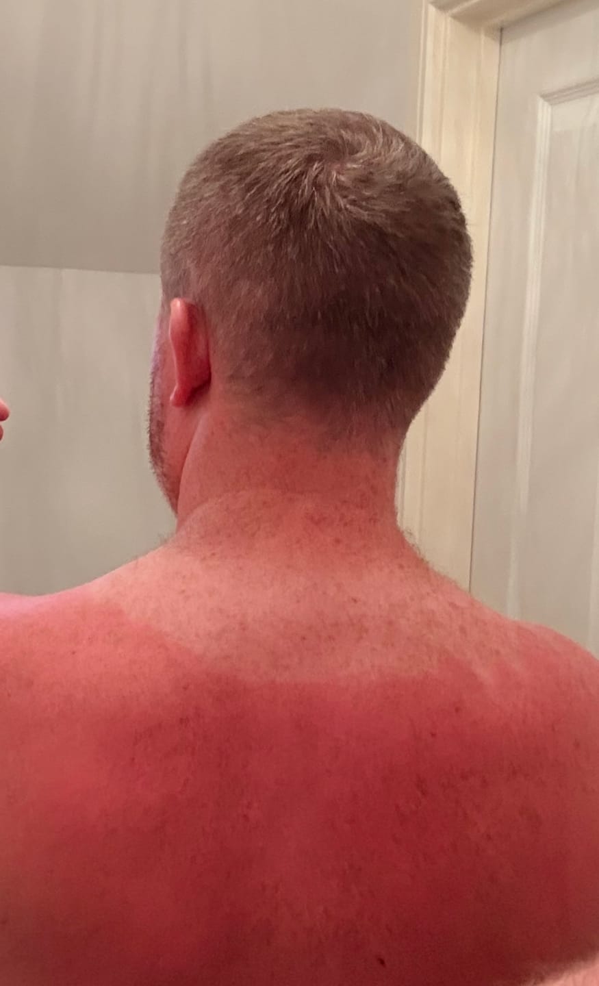 Customer photo review of Natural Mineral Sunscreen Lotion