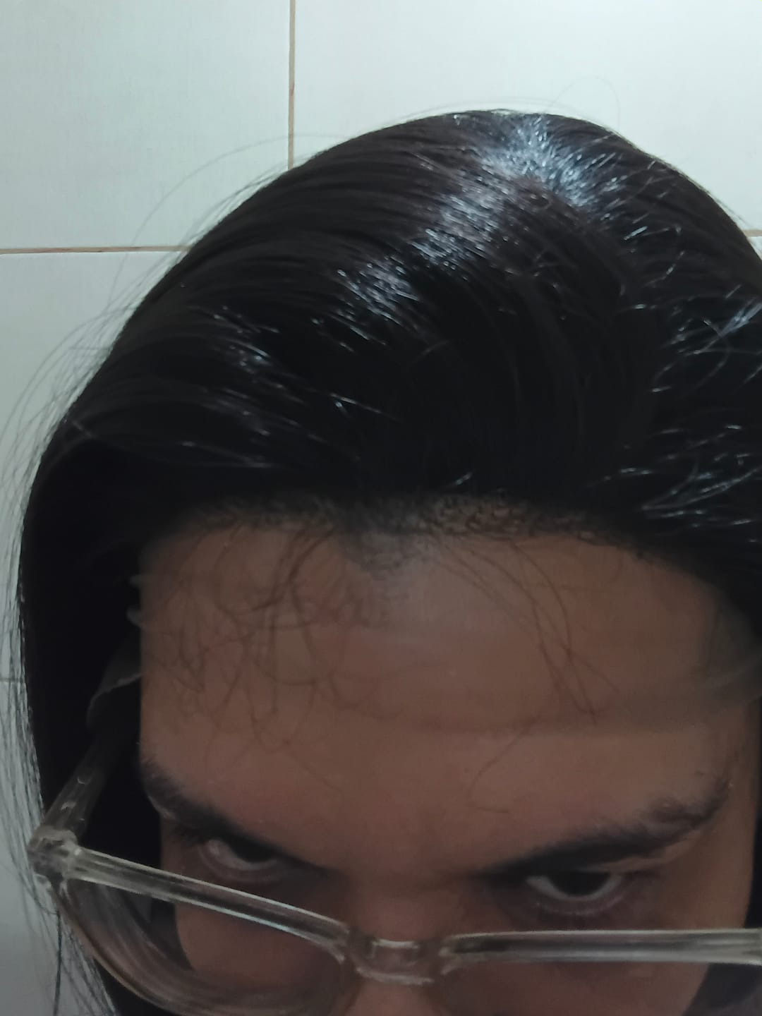 Customer photo review of Lace Front Tela HD Diamante Castanho Escuro Ondulada - Repartição Livre 13x2