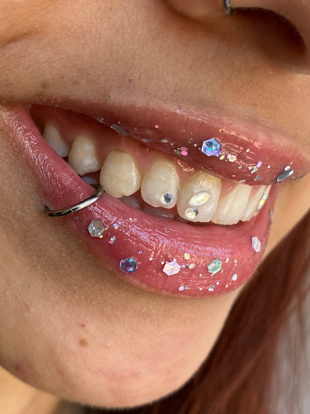 Customer photo review of Formación técnico de joyería dental online - Curso online de gemas dentales