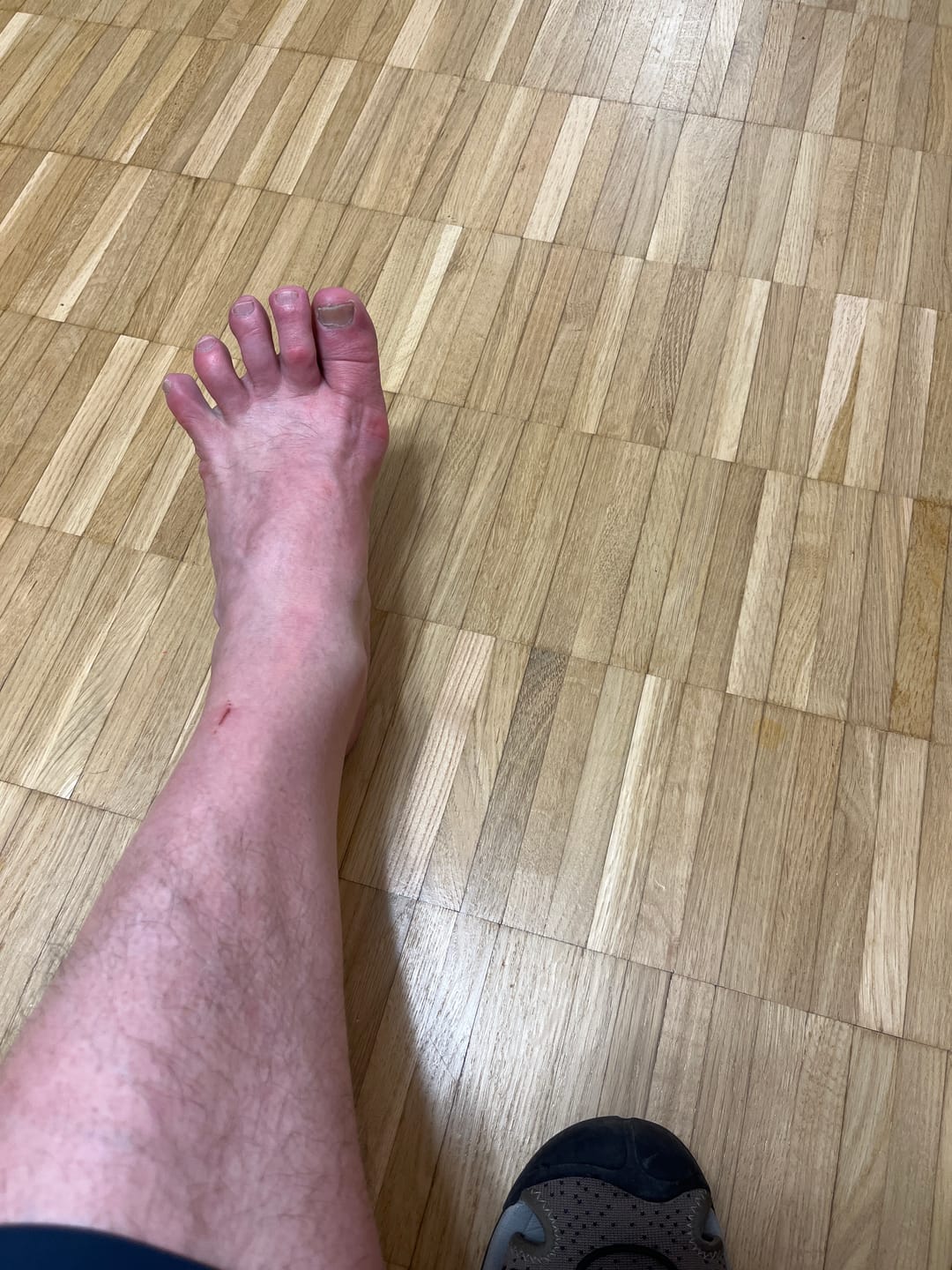 Customer photo review of Trek-Barfussschuh