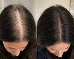 Customer photo review of SIERO PER CAPELLI