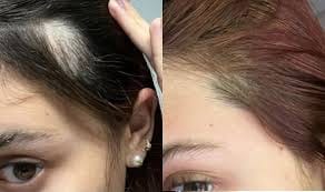 Customer photo review of SIERO PER CAPELLI