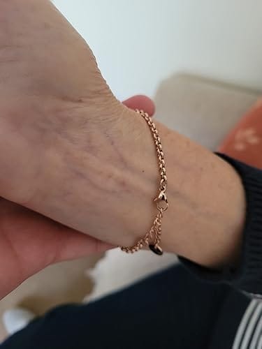 Customer photo review of Diabetes-Bewusstseins-Armband