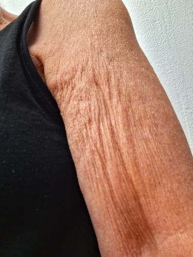 Customer photo review of NØRD BODY Peptide Body Oil