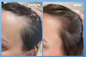 Customer photo review of SIERO PER CAPELLI