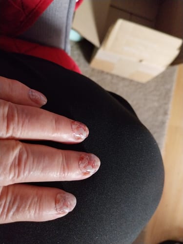 Nahaufnahme der Hand einer Kundin, die die 'Dreamy Blooms' UV-Gel-Nagelfolien auf kurzen Nägeln trägt.
