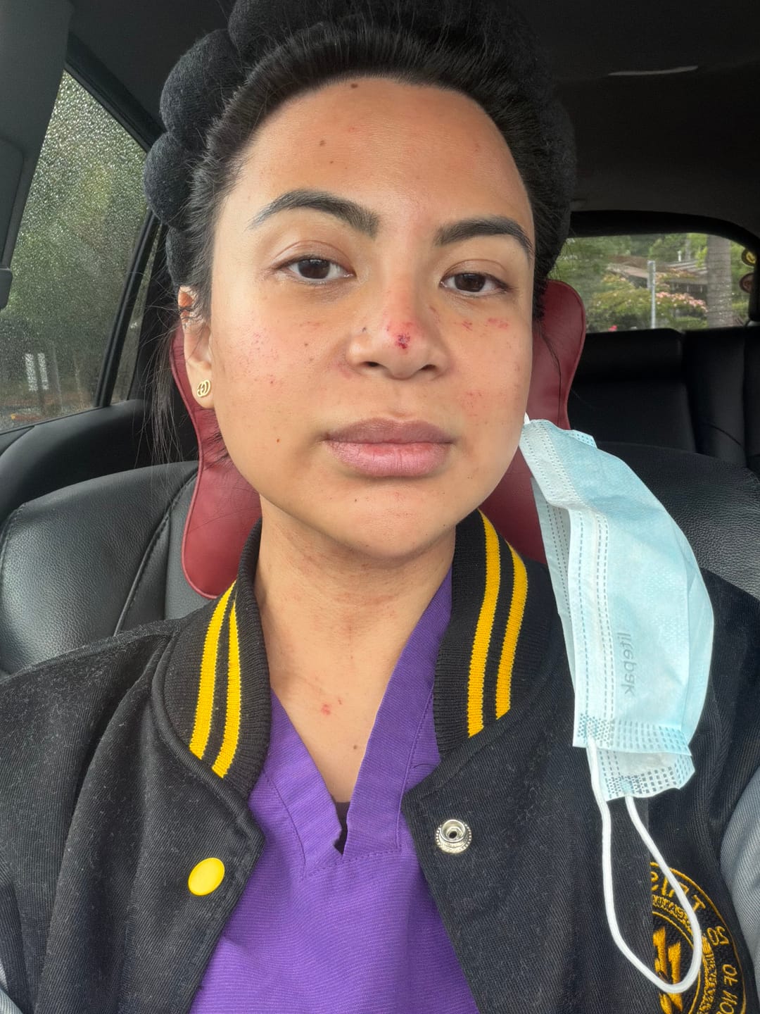 Customer photo review of SELENDERM Peptain P5 Infusion Ampoules