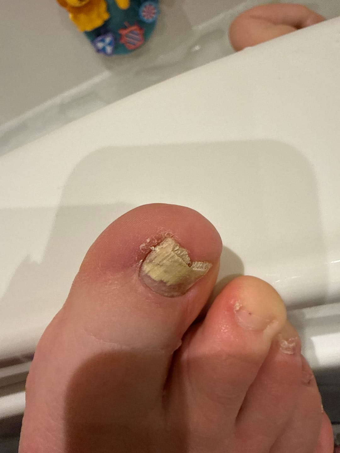 Customer photo review of Fungal Freedom