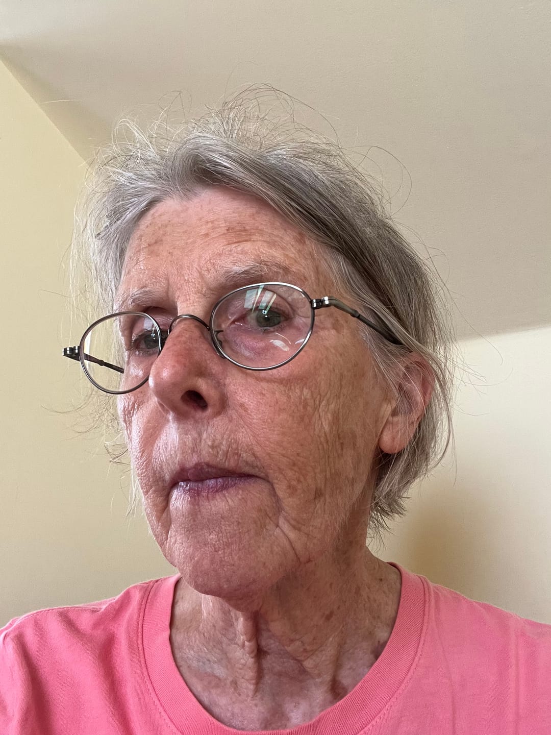 Customer photo review of Zygo Tape - Facial Sculpting & Anti-Aging Tape For Women