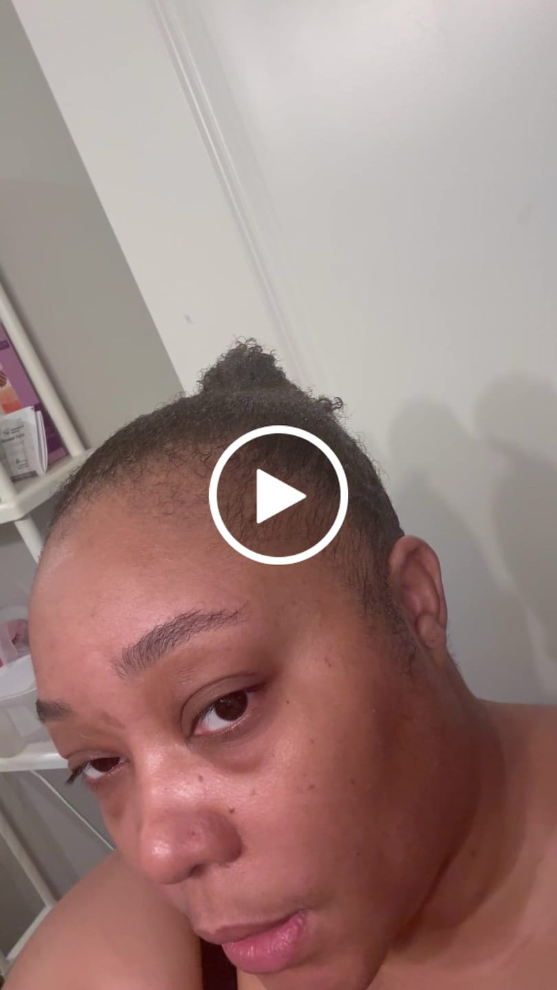 Customer video review of JUMBO Scalp Stimulator
