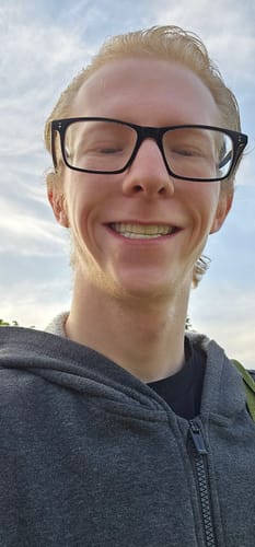 Customer with glasses smiling widely outdoors, showing their Pop On Veneers.