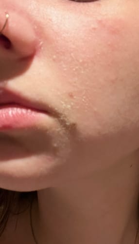 Customer photo review of Seb Natural Calming Serum
