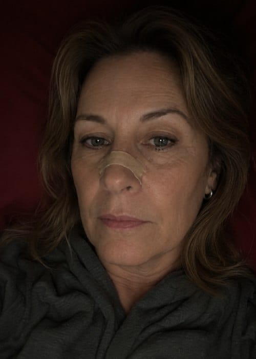 Customer photo review of nordicalm™ Nasal Strips for Sleep