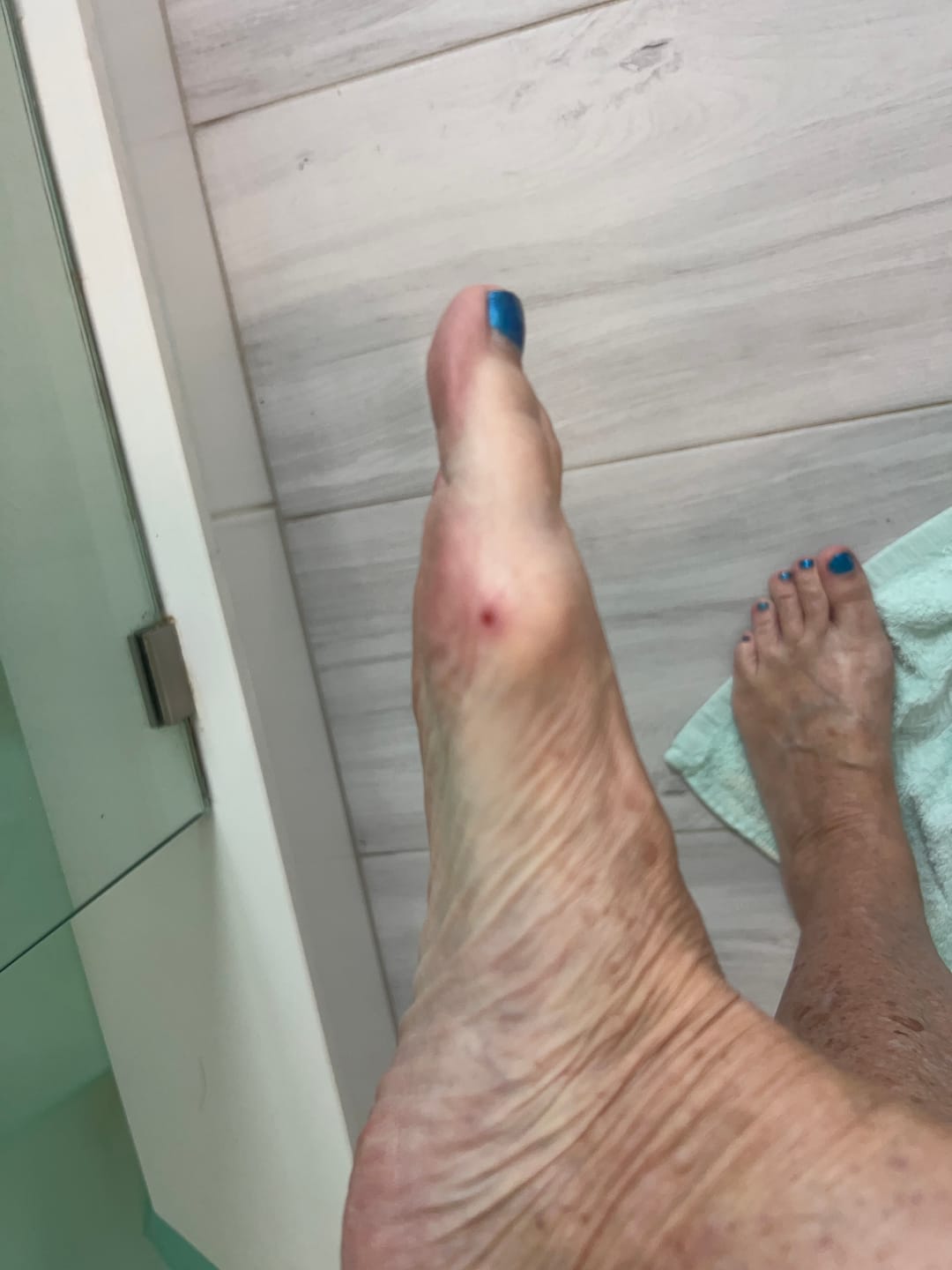 Customer photo review of WolfPaw - Barefoot Shoes