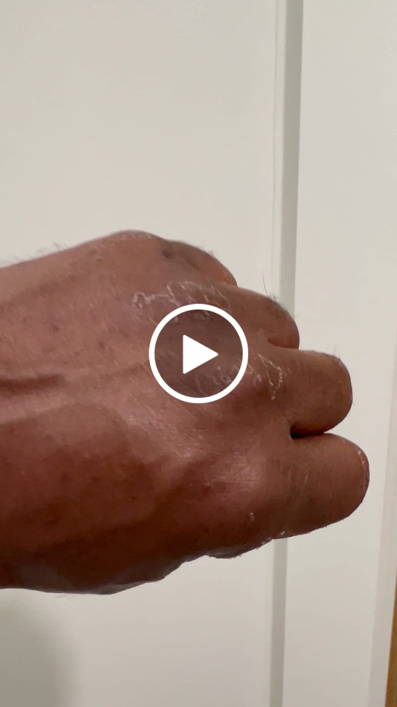 Customer video review of Wrinkle Defense Tallow Balm
