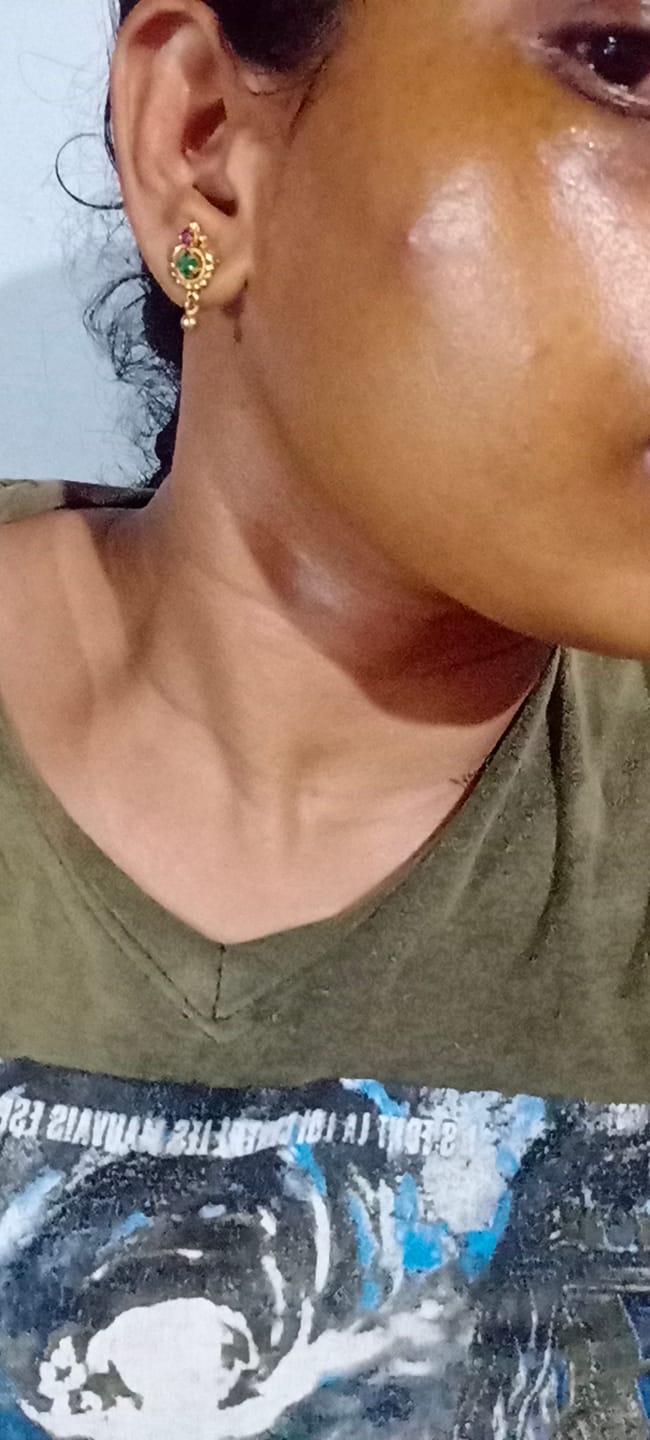 Customer photo review of Turmeric Night Repair Cream