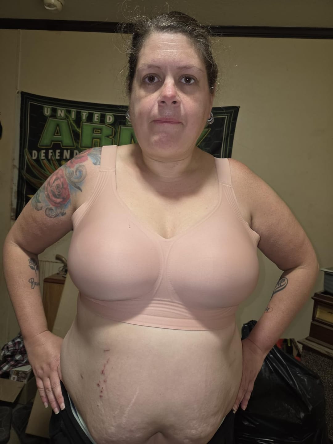 Customer photo review of Il Reggiseno Gel Lift 3D Shape Up™