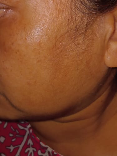 Customer photo review of Super Silk