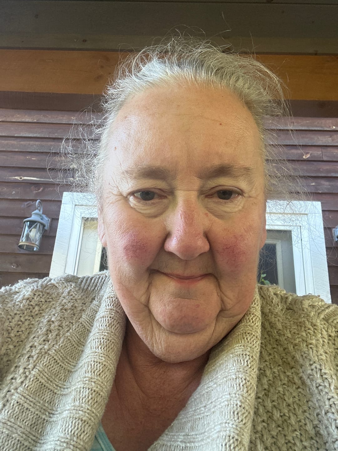 Customer photo review of Koriderm™ Time Reverse Cream (All-In-One)
