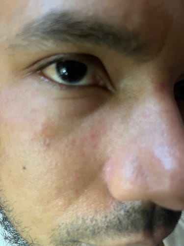 Customer photo review of Seb Natural Calming Serum