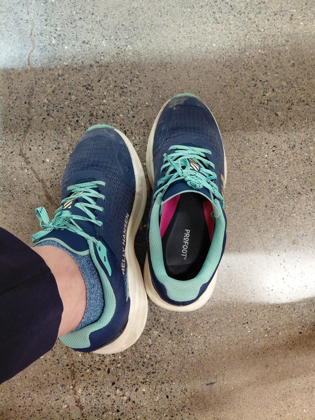 Customer photo review of Talonera Fascitis Plantar Mujer