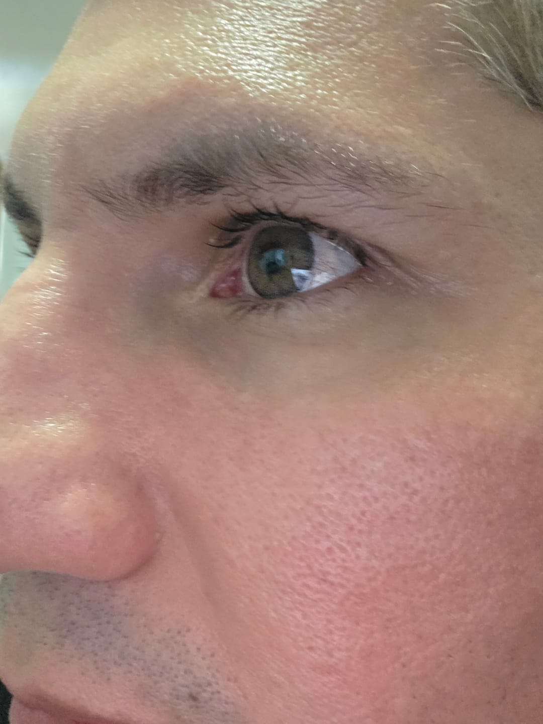 Customer photo review of Premium Candy Gray Prescription Colored Contact Lenses