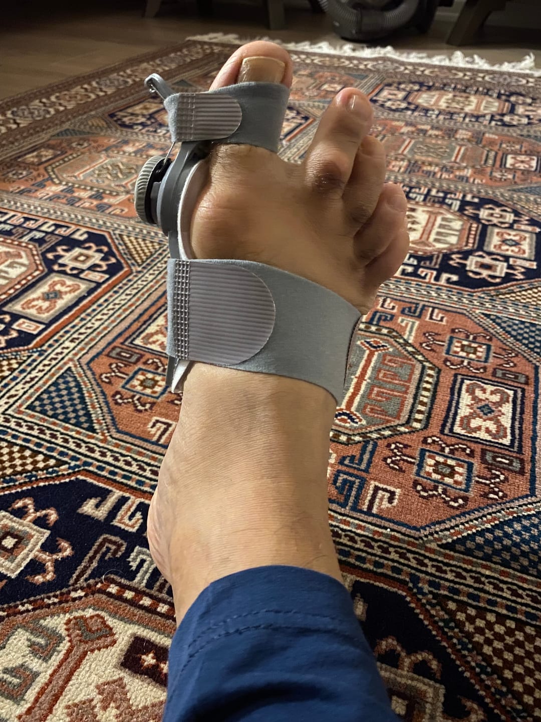 Customer photo review of Foot Medikal™ Ayak Ateli
