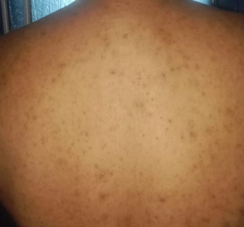 Customer photo review of Spot Doctor