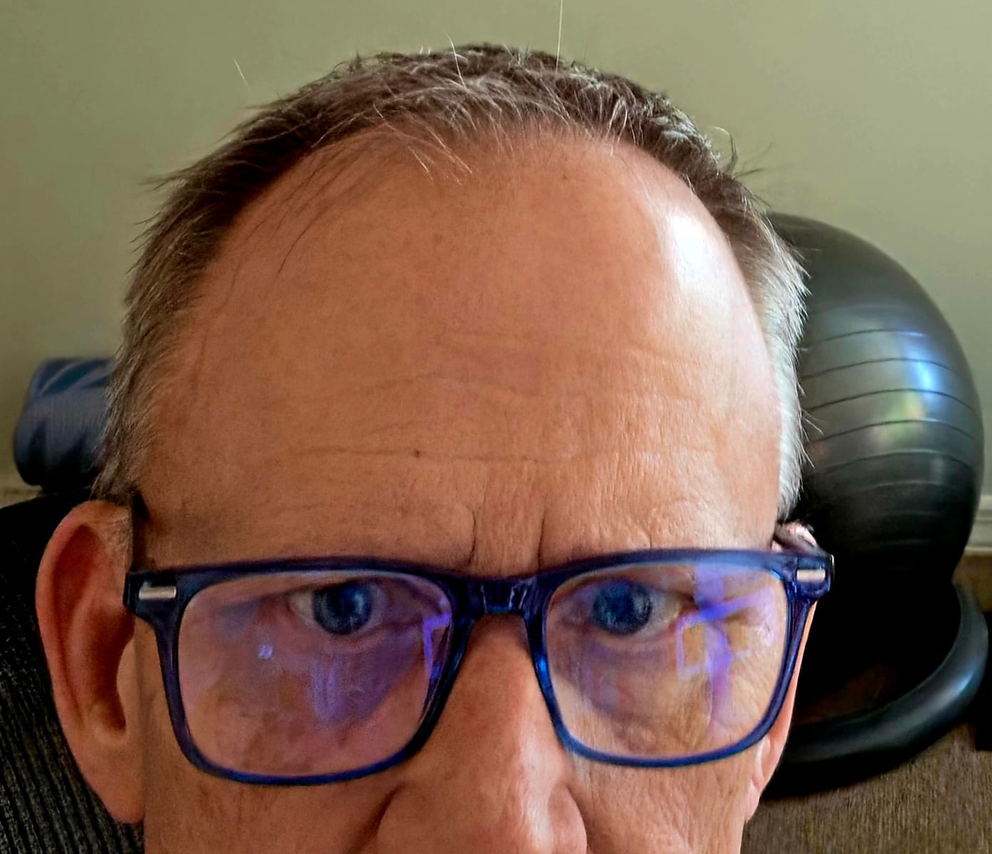 Customer photo review of Lumadux Anti Blue Light Glasses