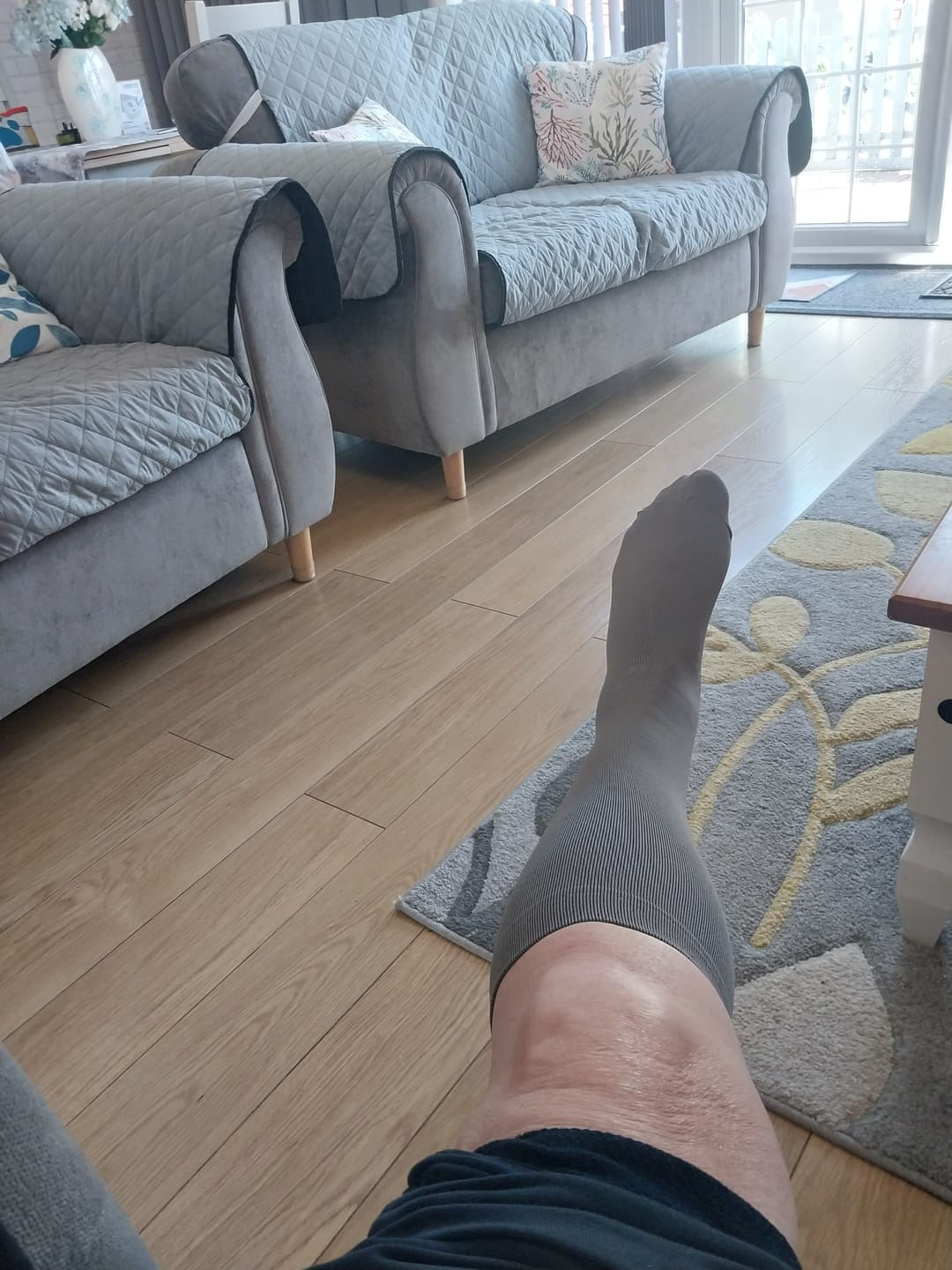 Customer photo review of EverSock™ Men's Wide Compression Socks For Pain Relief