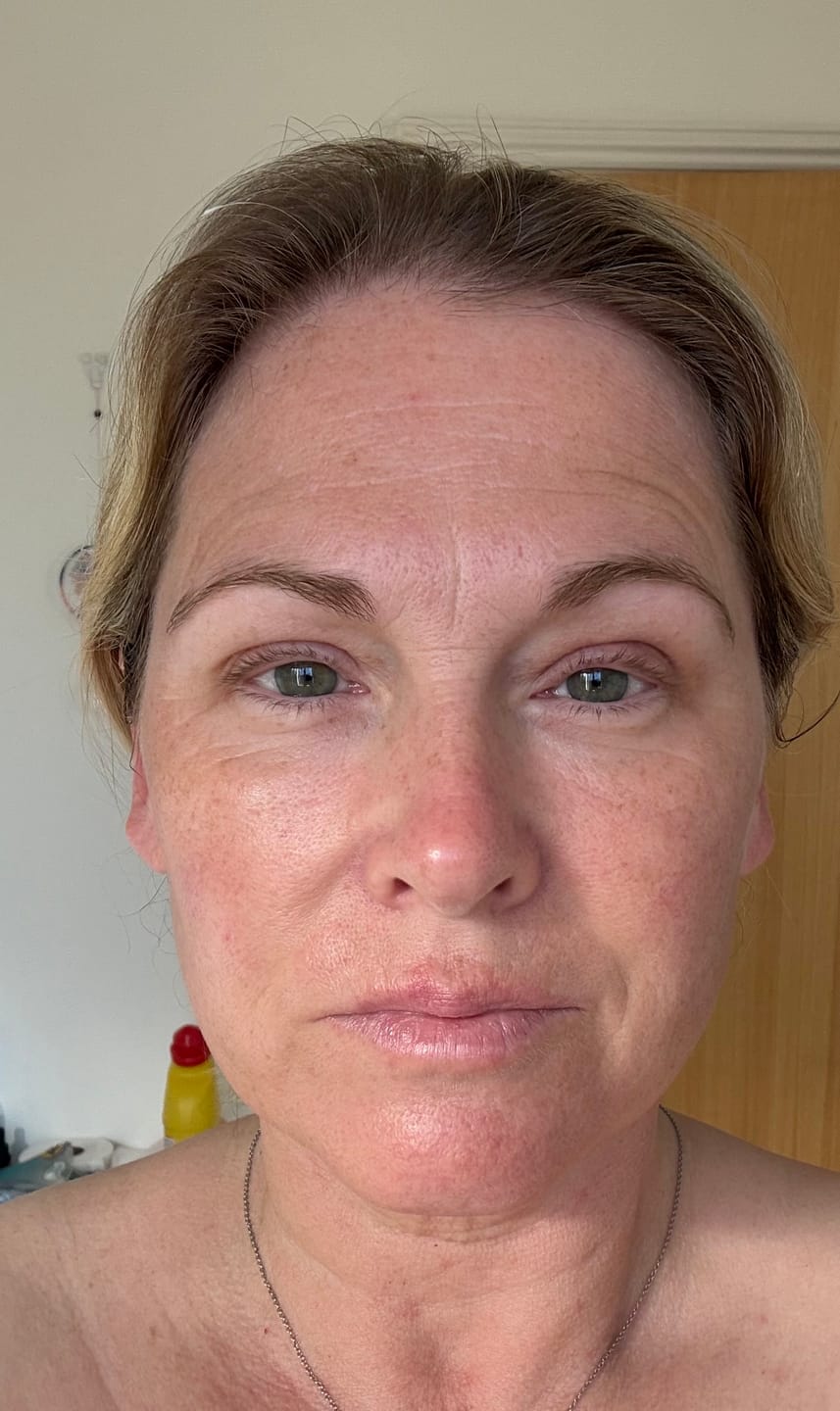 Customer photo review of Pro-Ageing Plump & Firm Duo