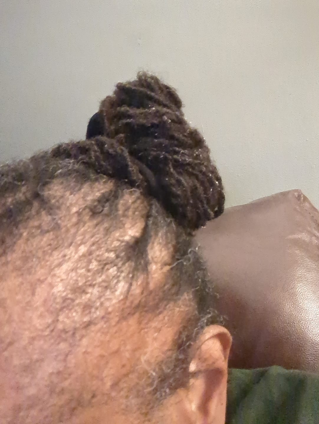 Customer photo review of Rennora Hair Growth Serum