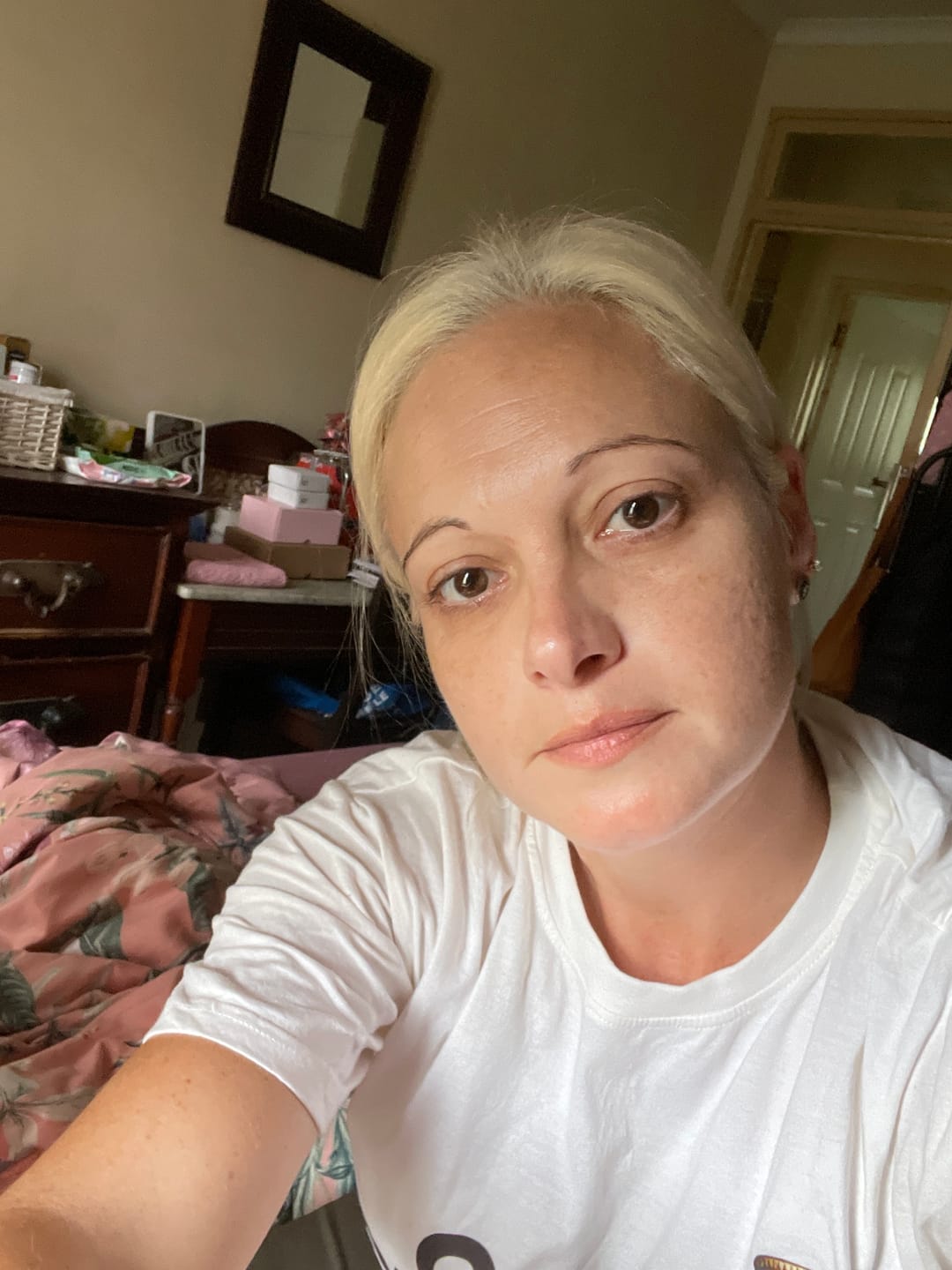 Customer photo review of The Glo Repair Cream
