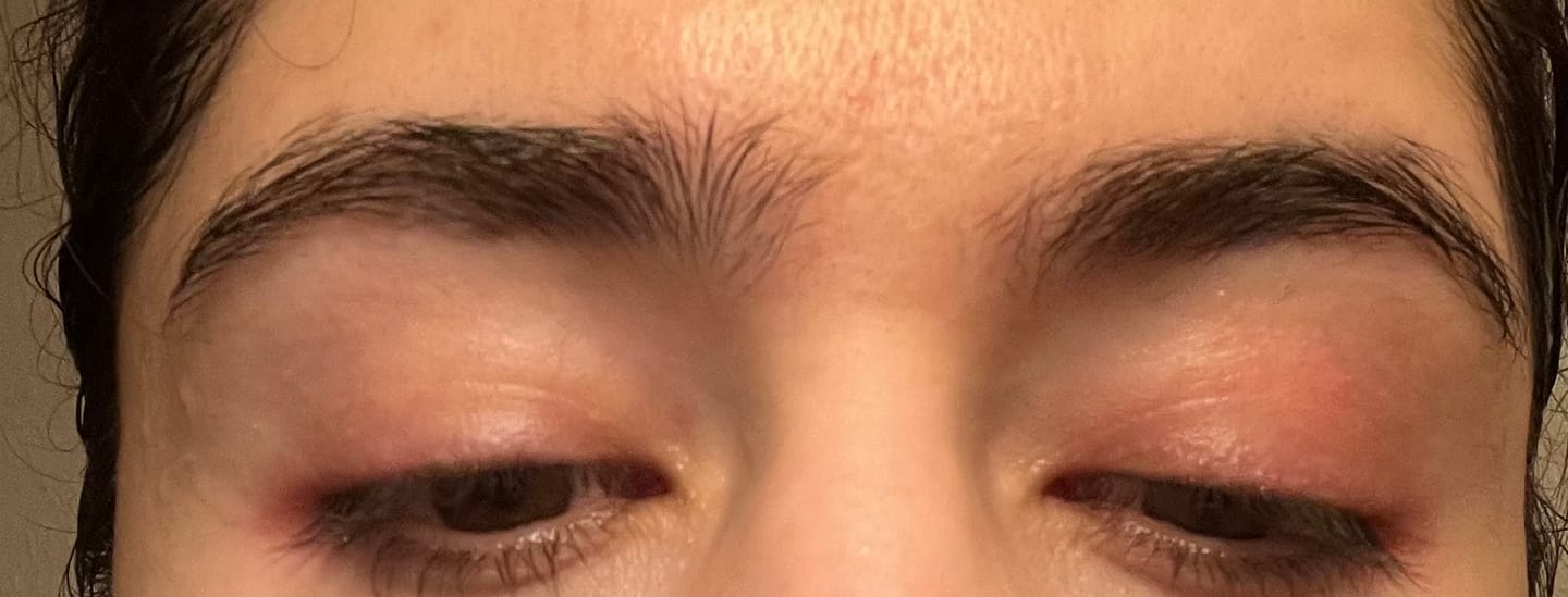 Customer photo review of LASHCOCA!NE - Wimpernserum