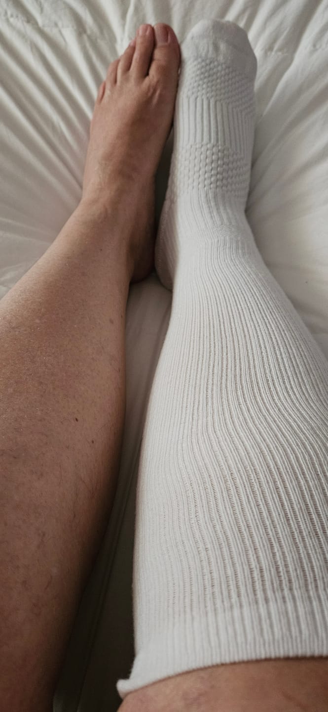 Customer photo review of White Compression Socks