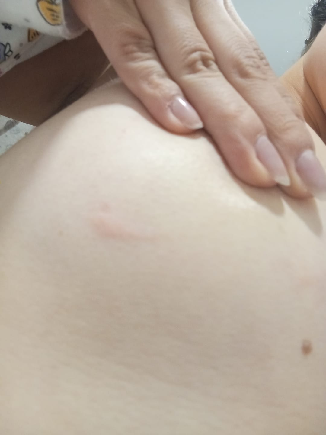 Customer photo review of Pezoneras Triángulos sin Adhesivo