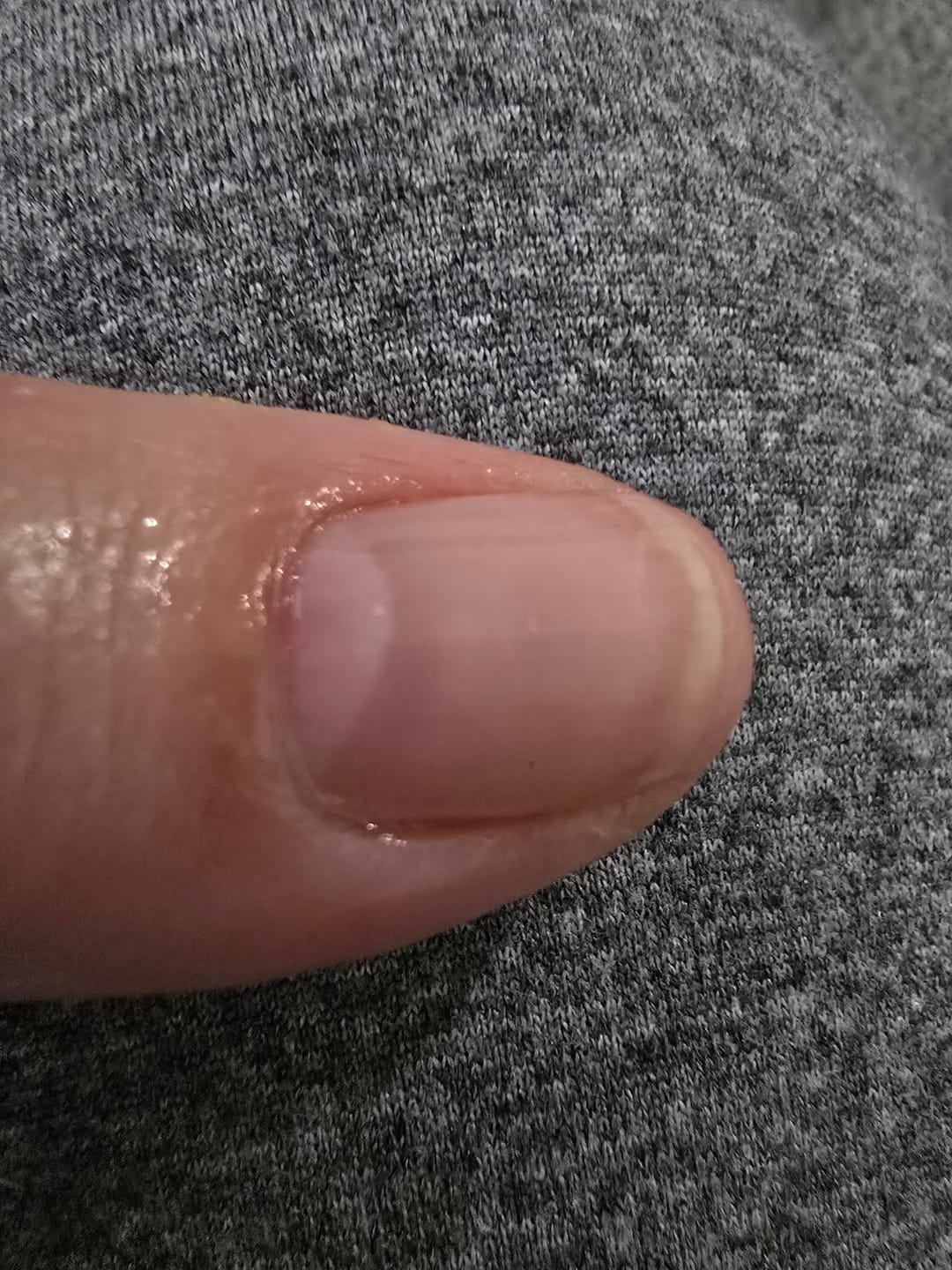 Customer photo review of Aceite de Cutícula