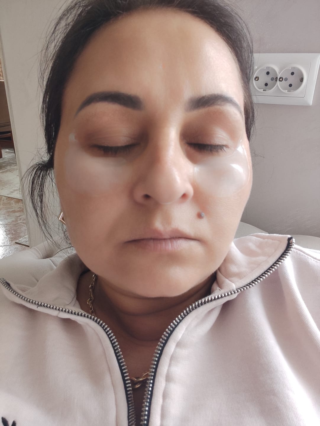 Customer photo review of Витамин C-Тека “Тройна сила” Пачове против несъвършенства CKD Vita C Teca Triple Blemish Patch(60 Patches)