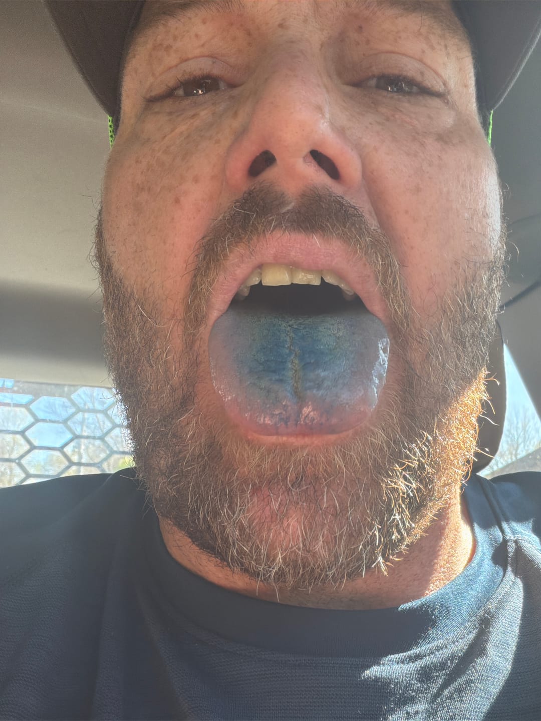 Customer photo review of (Renewal) Methylene Blue Tincture