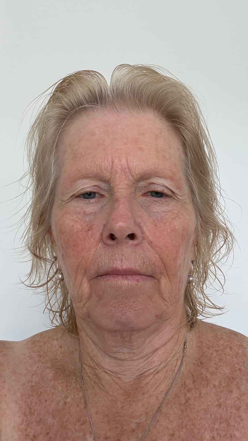 Customer photo review of Sea Cucumber Collagen Day & Night Pack