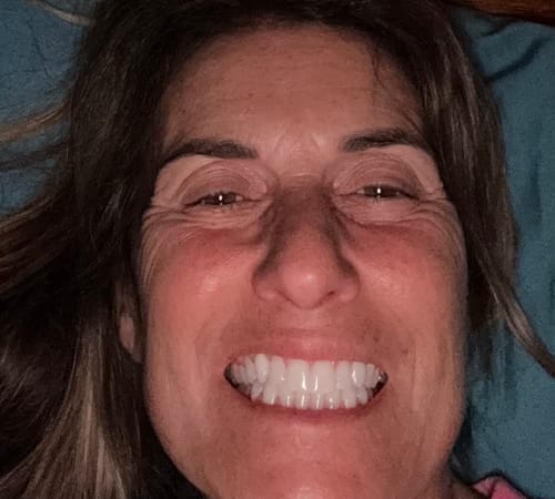 Reseña de una clienta de Orelvie mostrando sus dientes