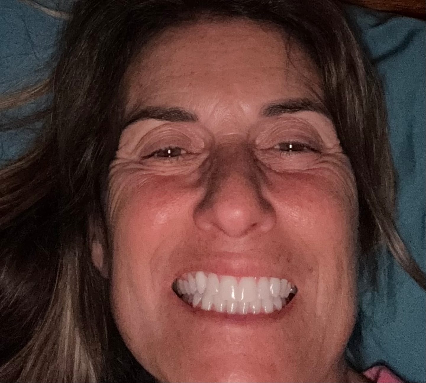 Customer photo review of Novelix™ Pro Gold Whitening Pen