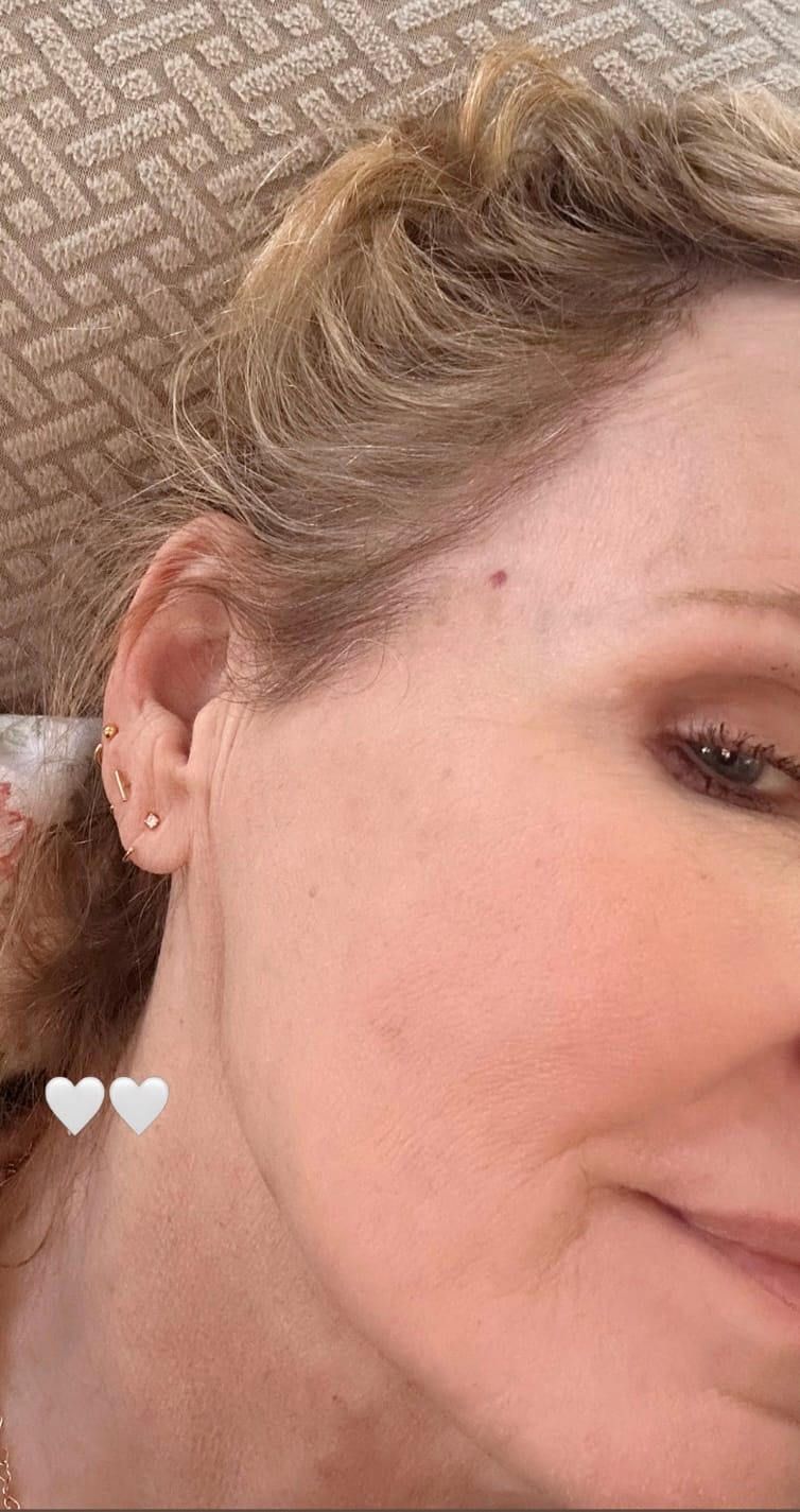 Customer photo review of Stay Close Hoops Set