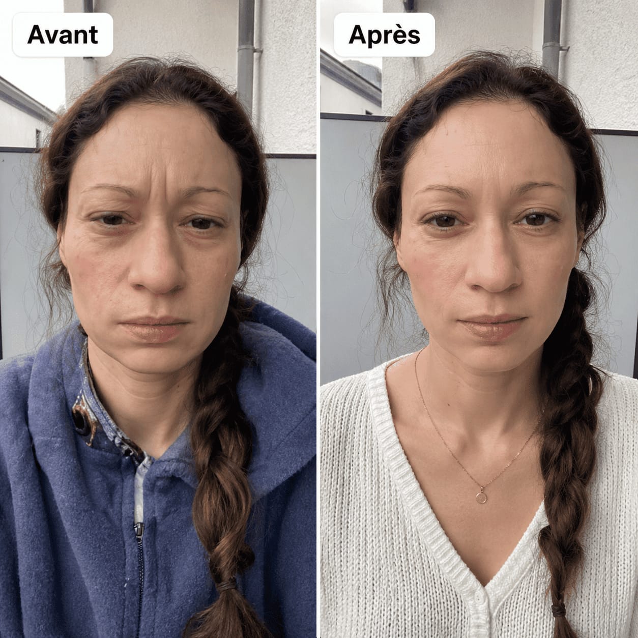 Customer photo review of Ventre plat, tête calme, nuits complètes. Sans régime, sans médicament