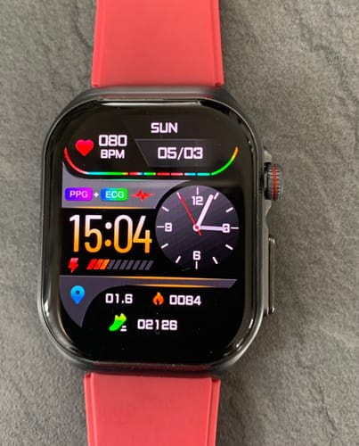 Customer photo review of Orthowatch Arca